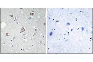 Immunohistochemistry analysis of paraffin-embedded human brain tissue, using GRM2 Antibody. (GRM2 anticorps  (AA 241-290))