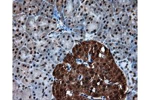 Immunohistochemical staining of paraffin-embedded colon tissue using anti-ACLY mouse monoclonal antibody. (ACLY anticorps)