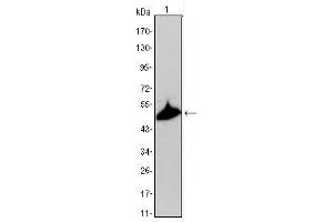 Western blot analysis using KRT15 mouse mAb against A431 cell lysate. (KRT15 anticorps)