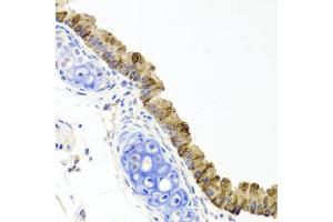 Immunohistochemistry of paraffin-embedded mouse lung using TOPBP1 antibody.