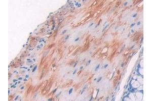 Detection of COL2a1 in Mouse Small intestine Tissue using Polyclonal Antibody to Collagen Type II Alpha 1 (COL2a1)