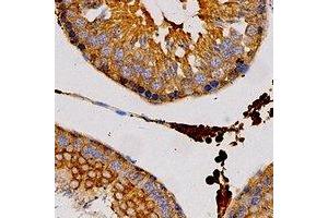 Immunohistochemical analysis of H-FABP staining in human testis formalin fixed paraffin embedded tissue section.