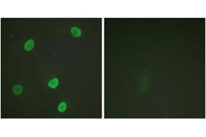 Immunofluorescence analysis of HeLa cells, using Histone H4 (Acetyl-Lys8) Antibody. (Histone H4 anticorps  (acLys8))