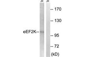 Western blot analysis of extracts from Jurkat cells, using eEF2K (Ab-359) Antibody. (EEF2K anticorps  (AA 336-385))