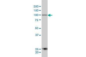 ARTS-1 monoclonal antibody (M01), clone 4H8 Western Blot analysis of ARTS-1 expression in A-431 .