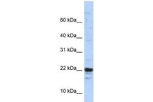 KIAA0040 antibody used at 5 ug/ml to detect target protein.