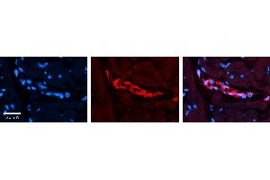 Rabbit Anti-AKT1S1 Antibody   Formalin Fixed Paraffin Embedded Tissue: Human heart Tissue Observed Staining: Cytoplasmic in endothelial cells in blood vessels Primary Antibody Concentration: 1:100 Other Working Concentrations: N/A Secondary Antibody: Donkey anti-Rabbit-Cy3 Secondary Antibody Concentration: 1:200 Magnification: 20X Exposure Time: 0.