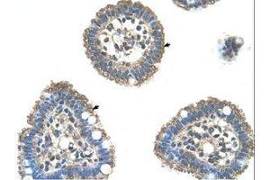 Image no. 1 for anti-Ubiquitin-Conjugating Enzyme E2L 3 (UBE2L3) (C-Term) antibody (ABIN203476)