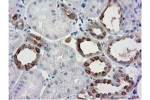 Immunohistochemical staining of paraffin-embedded Human Kidney tissue using anti-BECN1 mouse monoclonal antibody. (Beclin 1 anticorps)