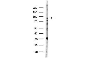 anti-Protein Kinase D1 (PRKD1) (pSer205) antibody