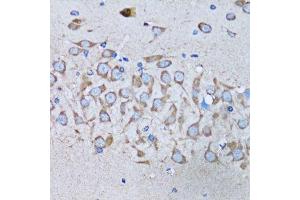 Immunohistochemistry of paraffin-embedded mouse brain using IRAK4 antibody.