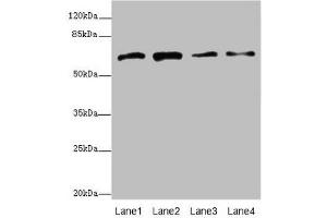 Western blot All lanes: GALNT2 antibody at 4. (GALNT2 anticorps  (AA 442-571))