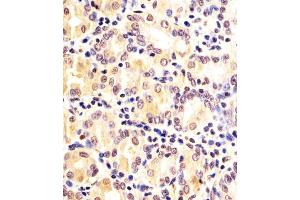 (ABIN6242334 and ABIN6578174) staining FN3KRP in human Stomach sections by Immunohistochemistry (IHC-P - paraformaldehyde-fixed, paraffin-embedded sections). (FN3KRP anticorps  (AA 24-58))