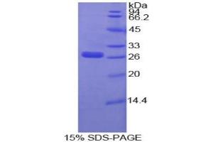 SDS-PAGE of Protein Standard from the Kit (Highly purified E. (IGFBP4 Kit CLIA)