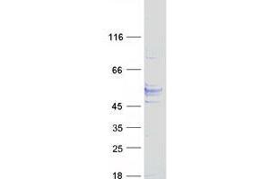 Validation with Western Blot