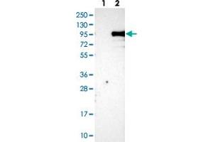 Western blot analysis of Lane 1: Negative control (vector only transfected HEK293T lysate), Lane 2: Over-expression Lysate (Co-expressed with a C-terminal myc-DDK tag (~3. (KIAA1586 anticorps)
