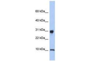 Image no. 1 for anti-Ribosomal Protein S21 (RPS21) (N-Term) antibody (ABIN6744006) (RPS21 anticorps  (N-Term))