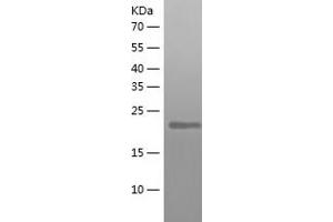 Western Blotting (WB) image for D-Tyrosyl-tRNA Deacylase 1 Homolog (S. Cerevisiae) (DTD1) (AA 1-209) protein (His-IF2DI Tag) (ABIN7122597)