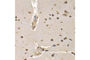 Immunohistochemistry of paraffin-embedded rat brain using HIST4H4 antibody (ABIN5970479) at dilution of 1/200 (40x lens). (HIST4H4 anticorps)