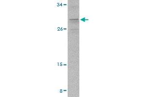 Western blot analysis of PIGY in A-20 cell lysate with PIGY polyclonal antibody  at 2 ug/mL . (PIGY anticorps  (C-Term))