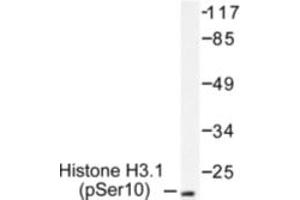 Image no. 1 for anti-Histone H3.1 (HIST1H3B) (pSer10) antibody (ABIN318041) (Histone H3.1 anticorps  (pSer10))