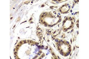 Immunohistochemistry of paraffin-embedded Human breast using HDAC4 Polyclonal Antibody at dilution of 1:100 (40x lens).