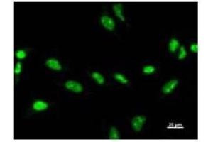 Immunostaining analysis in HeLa cells. (ZSCAN21 anticorps)