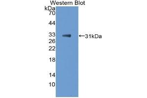 Detection of Recombinant TBX21, Mouse using Polyclonal Antibody to T-Box Protein 21 (TBX21) (T-Bet anticorps  (AA 160-399))