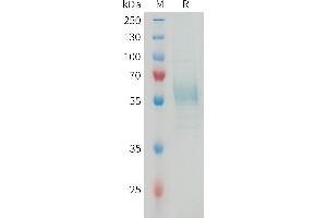 Mouse T Protein, hFc Tag on SDS-PAGE under reducing condition.