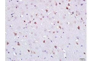 Paraformaldehyde-fixed, paraffin embedded mouse brain tissue, Antigen retrieval by boiling in sodium citrate buffer(pH6) for 15min, Block endogenous peroxidase by 3% hydrogen peroxide for 30 minutes, Blocking buffer (normal goat serum) at 37°C for 20min, Antibody incubation with Rabbit Anti-CNG Channel beta 1 Polyclonal Antibody, Unconjugated  at 1:400 overnight at 4°C, followed by a conjugated secondary and DAB staining (CNG Channel beta 1/truncated GARP (AA 851-950) anticorps)