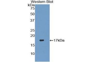 WB of Protein Standard: different control antibodies against Highly purified E. (TGFB3 Kit CLIA)