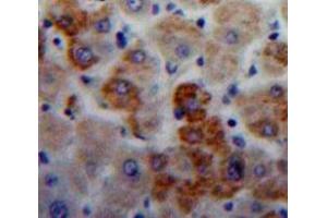 Used in DAB staining on fromalin fixed paraffin-embedded Liver tissue