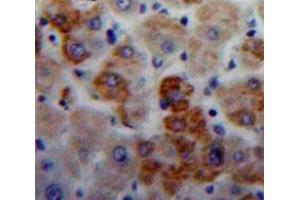 Used in DAB staining on fromalin fixed paraffin-embedded Liver tissue (IGLL1 anticorps  (AA 112-206))