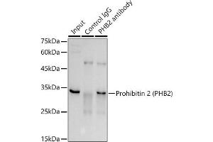 Immunoprecipitation analysis of 300 μg extracts of A-549 cells using 3 μg Prohibitin 2 (PHB2) antibody (ABIN1681345, ABIN3018997, ABIN3018998, ABIN5664807 and ABIN6220664). (Prohibitin 2 anticorps  (AA 1-299))