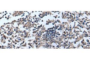 Immunohistochemistry of paraffin-embedded Human tonsil tissue using APOD Polyclonal Antibody at dilution of 1:55(x200)
