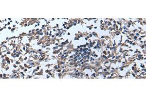 Immunohistochemistry of paraffin-embedded Human tonsil tissue using APOD Polyclonal Antibody at dilution of 1:55(x200) (Apolipoprotein D anticorps)