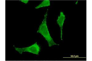 anti-6-phosphogluconolactonase (PGLS) (AA 1-258) antibody