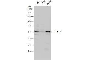 WB Image TRIM27 antibody detects TRIM27 protein by western blot analysis. (TRIM27 anticorps)
