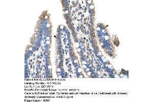 Human Intestine (SLC25A39 anticorps  (C-Term))