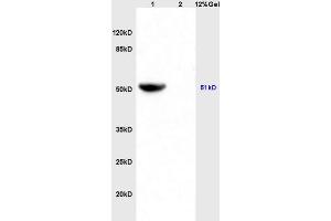 Lane 1: mouse heart lysates Lane 2: mouse brain lysates probed with Anti IDH2 Polyclonal Antibody, Unconjugated (ABIN751558) at 1:200 in 4 °C. (IDH2 anticorps  (AA 251-350))
