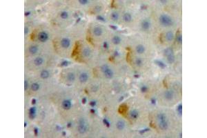 IHC-P analysis of Liver tissue, with DAB staining. (Insulin Receptor anticorps  (AA 1024-1298))