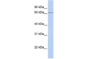 WB Suggested Anti-DNAJC1 Antibody Titration:  0. (DNAJC1 anticorps  (Middle Region))
