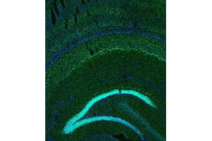 Indirect immunostaining of PFA fixed mouse brain section (dilution 1 : 200; green). (BCL11B anticorps)