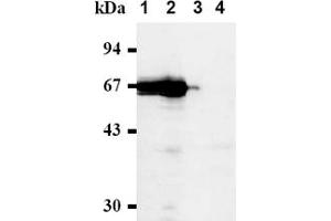 Western Blotting (WB) image for anti-Cell Division Cycle 7 (CDC7) antibody (ABIN487481) (CDC7 anticorps)
