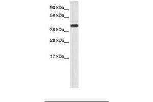 Image no. 1 for anti-CCR4-NOT Transcription Complex, Subunit 2 (CNOT2) (AA 112-161) antibody (ABIN202350) (CNOT2 anticorps  (AA 112-161))