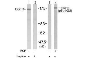 Image no. 2 for anti-Epidermal Growth Factor Receptor (EGFR) (Tyr1092) antibody (ABIN197230) (EGFR anticorps  (Tyr1092))