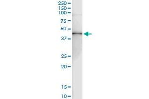 Immunoprecipitation of RRM2 transfected lysate using anti-RRM2 MaxPab rabbit polyclonal antibody and Protein A Magnetic Bead , and immunoblotted with RRM2 purified MaxPab mouse polyclonal antibody (B01P) .