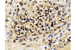 IHC analysis of EXOSC3 using anti-EXOSC3 antibody (ABIN7602216).