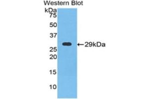 Western Blotting (WB) image for anti-Neuronal Pentraxin 1 (NPX1) (AA 146-384) antibody (ABIN1860045) (NPX1 anticorps  (AA 146-384))