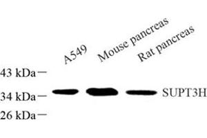 Western blot analysis of SUPT3H (ABIN7075767) at dilution of 1: 500 (SUPT3H/SPT3 anticorps)
